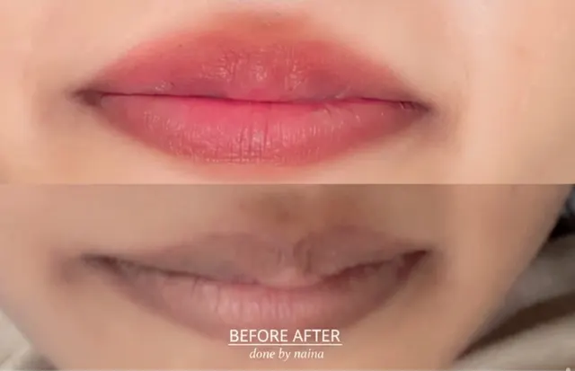 Lip tinting before and after — dark lips to soft pink